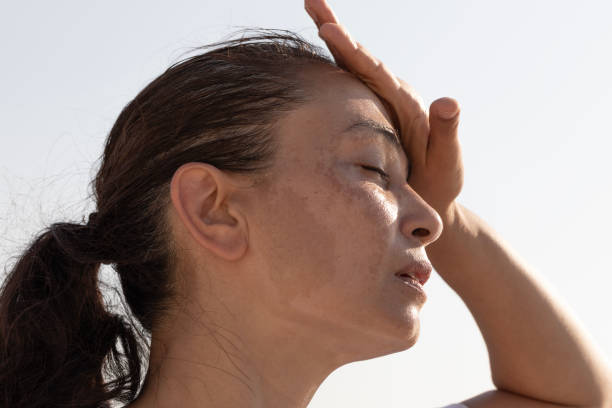 Hair Removal | A Dermatologist’s Guide to Treating Hyperpigmentation
