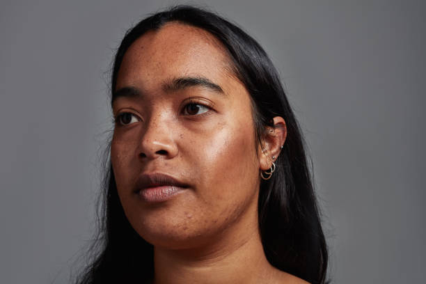 Hair Removal | A Dermatologist’s Guide to Treating Hyperpigmentation Hair Removal | A Dermatologist’s Guide to Treating Hyperpigmentation