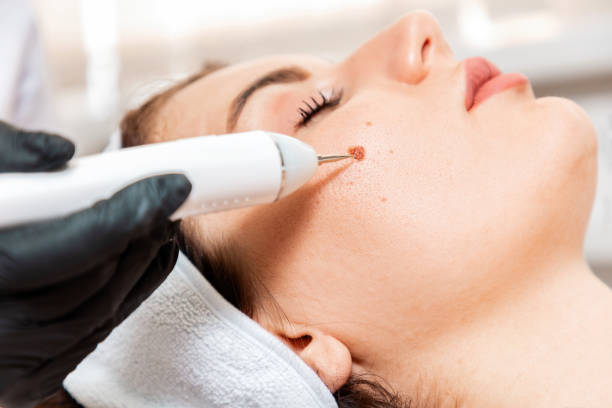 Hair Removal | A Dermatologist’s Guide to Treating Hyperpigmentation Hair Removal | A Dermatologist’s Guide to Treating Hyperpigmentation