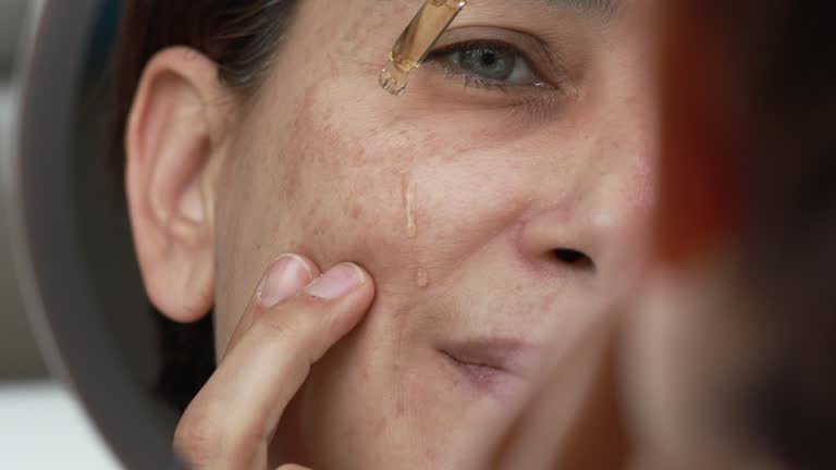 Hair Removal | A Dermatologist’s Guide to Treating Hyperpigmentation Hair Removal | A Dermatologist’s Guide to Treating Hyperpigmentation